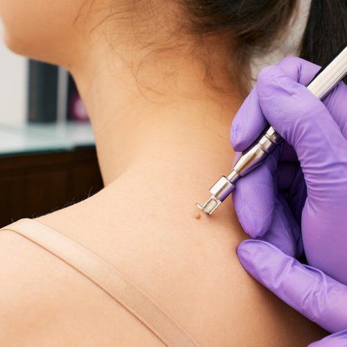 a woman wearing a blue dress